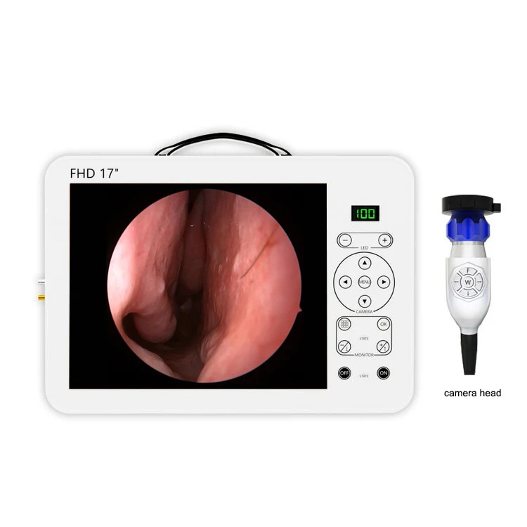 ชุดระบบวินิจฉัยทางหู คอ จมูก พ - Medical Lab Images บทวิจารณ์และราคา